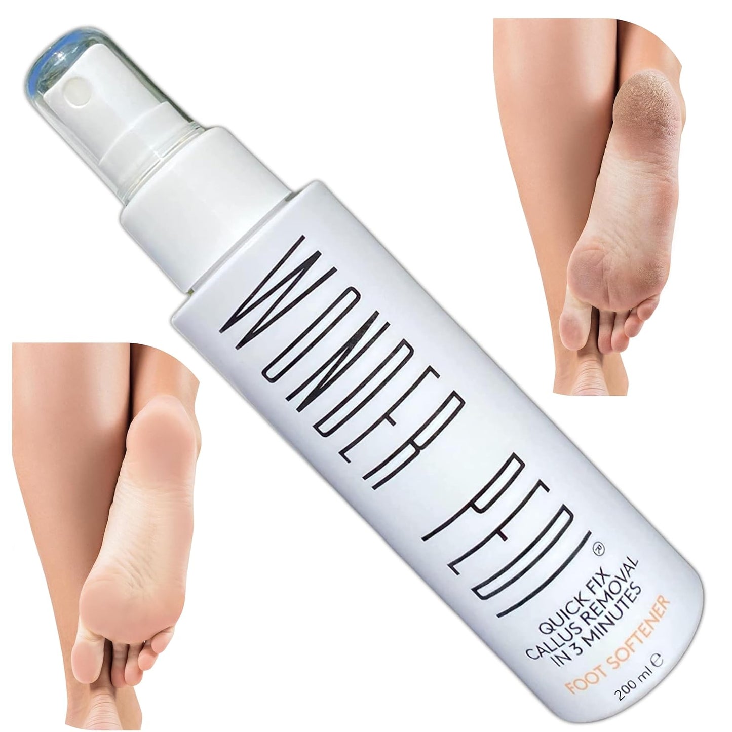 Callus Remover - Instant Exfoliating Peel Foot Spray - Feet Dead Skin Remover Cracked Heels Softener – Home Spa Pedicure Treatment - Works With any Foot File or Scrubber. Wonder Pedi