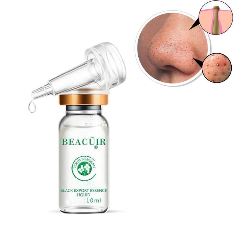 Blackhead Dissolve Serum